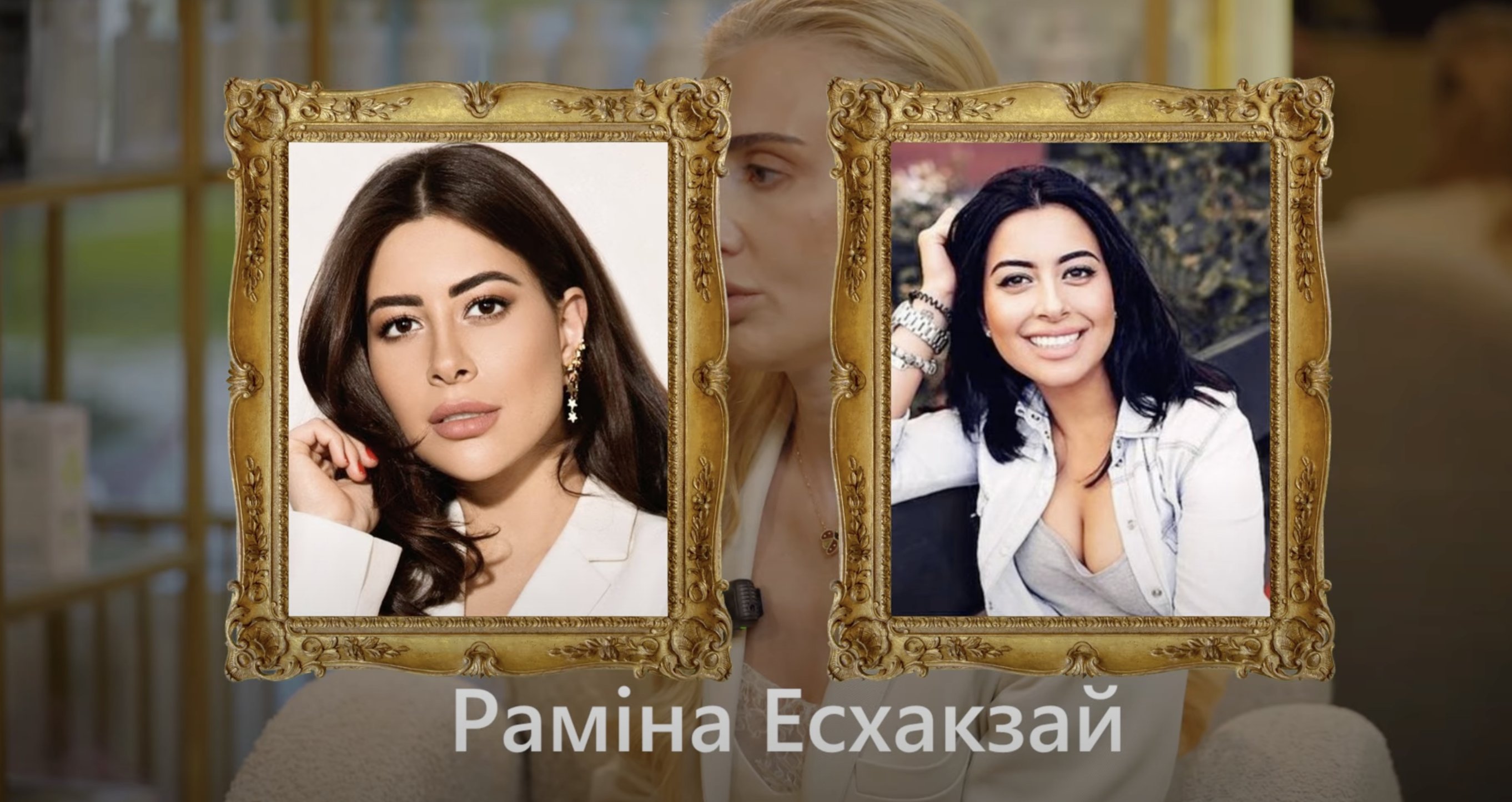 Чи робила Тіна Кароль пластичні операції? Експертка розкрила &quot;рецепт молодості&quot; співачки